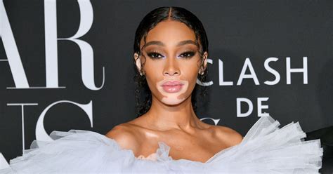 Winnie Harlow Net Worth 2024: What Is The Model。